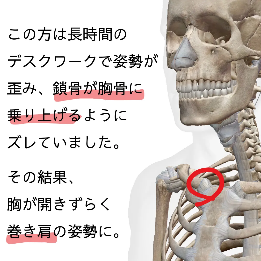 整形外科では治らなかった・・・1年続く肩の痛み｜【深夜でも整体・マッサージが受けられる　ほんだ整体院】